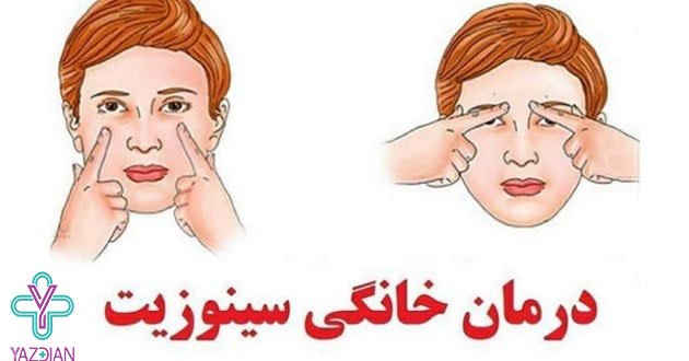 علائم و عوارض سینوزیت در بارداری